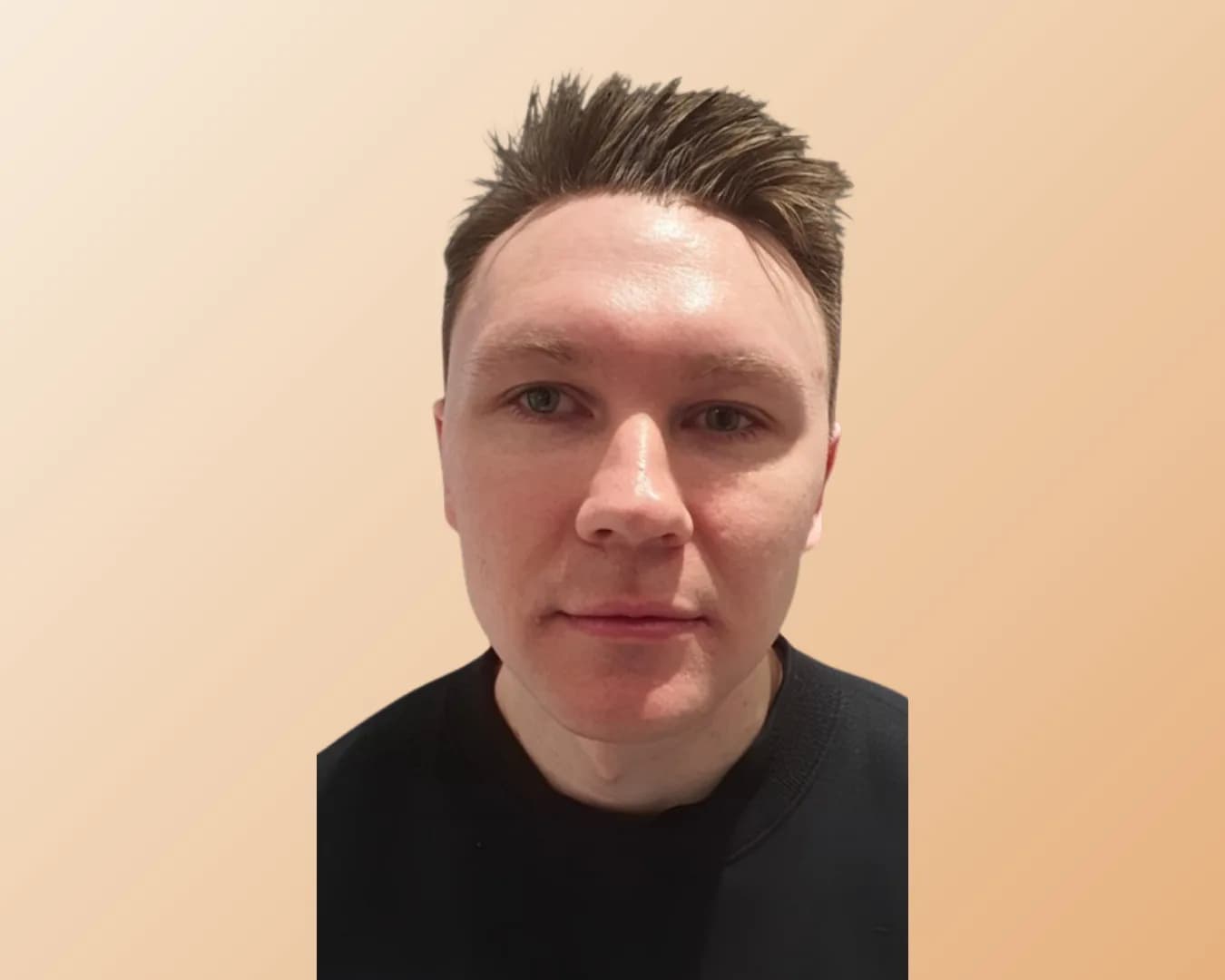 A man in a black t-shirt photographed face-on before treatment, with a softly defined jaw and chin