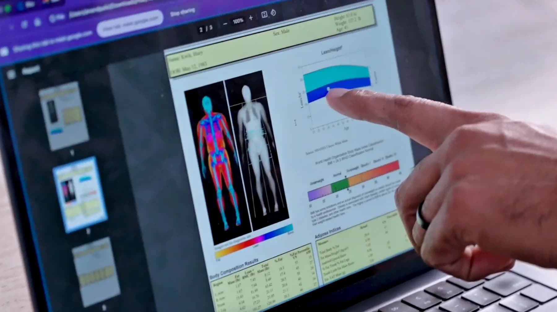 A hand pointing at a body composition scan report open on a laptop screen, beside its lean mass chart