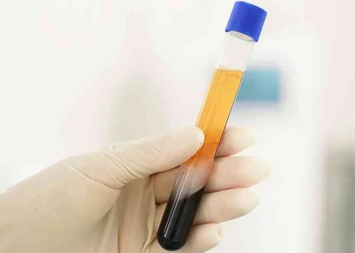 Gloved hand holding a centrifuged blood tube, straw-coloured plasma separated above the red cell layer